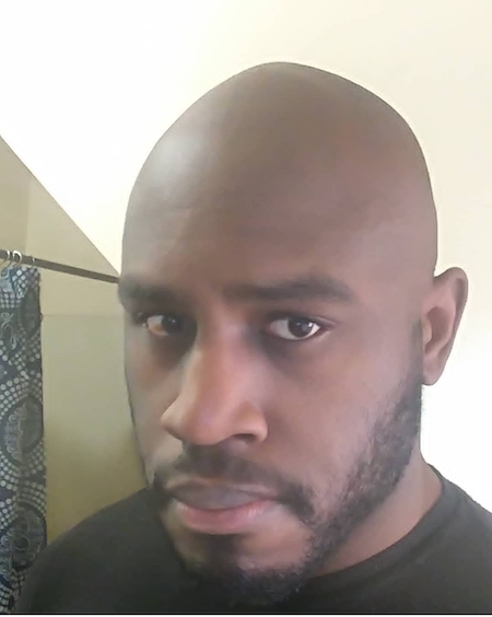 Should I shave my head?— Surprising pros and cons